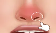 Nose Hospital