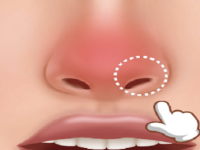 Play Nose Hospital now!